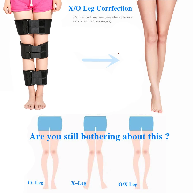 3pcs/set Effective O-leg X type leg bowed Legs Knee Valgum Straightening Correction Band Posture Corrector Beauty Leg Band Belt