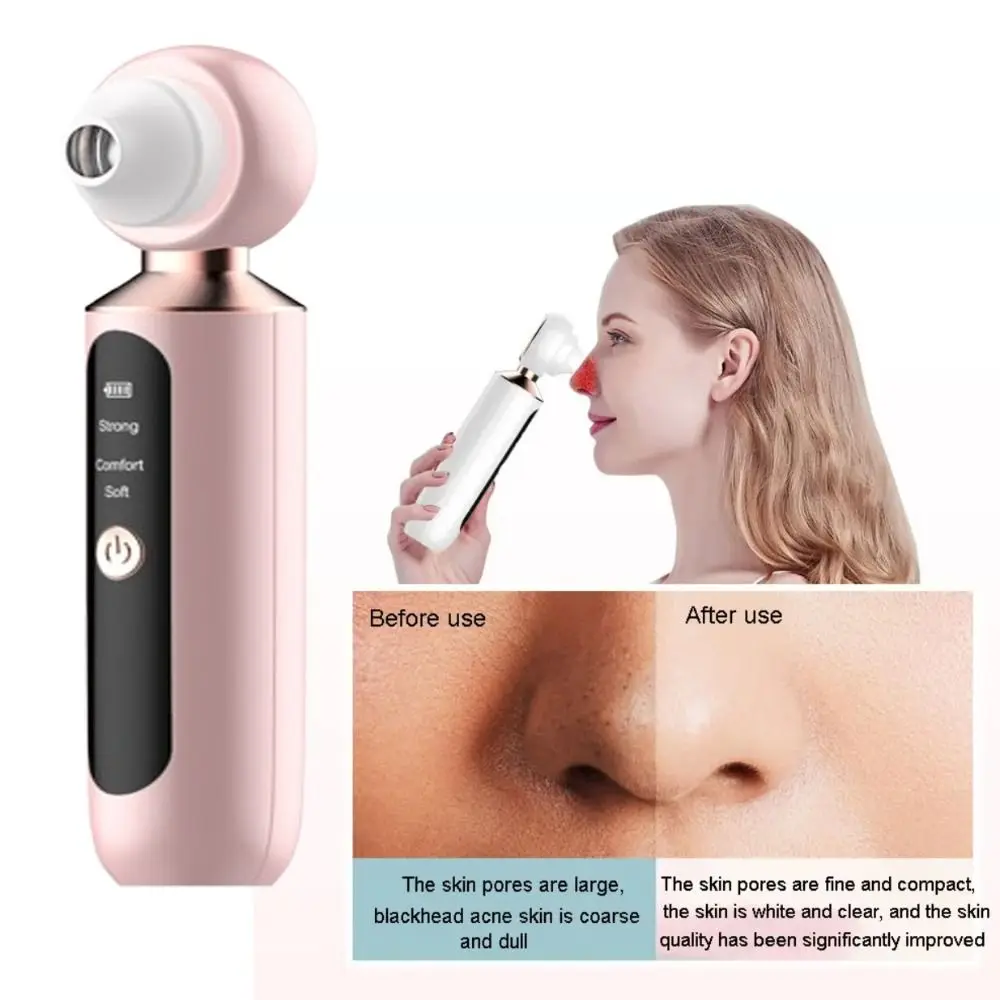 

Visual Electric Blackhead Remover Acne Remover Magnifying Glass Facial Blackhead Removal Instrument LED Pore Cleanser