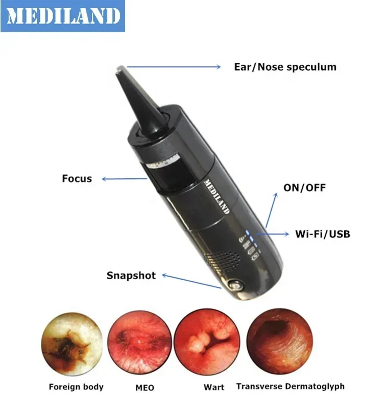 ML-402O Wifi Otoscope for  IOS/Android/WIndows HD video household otoscope wireless Endoscope to check ear and nose