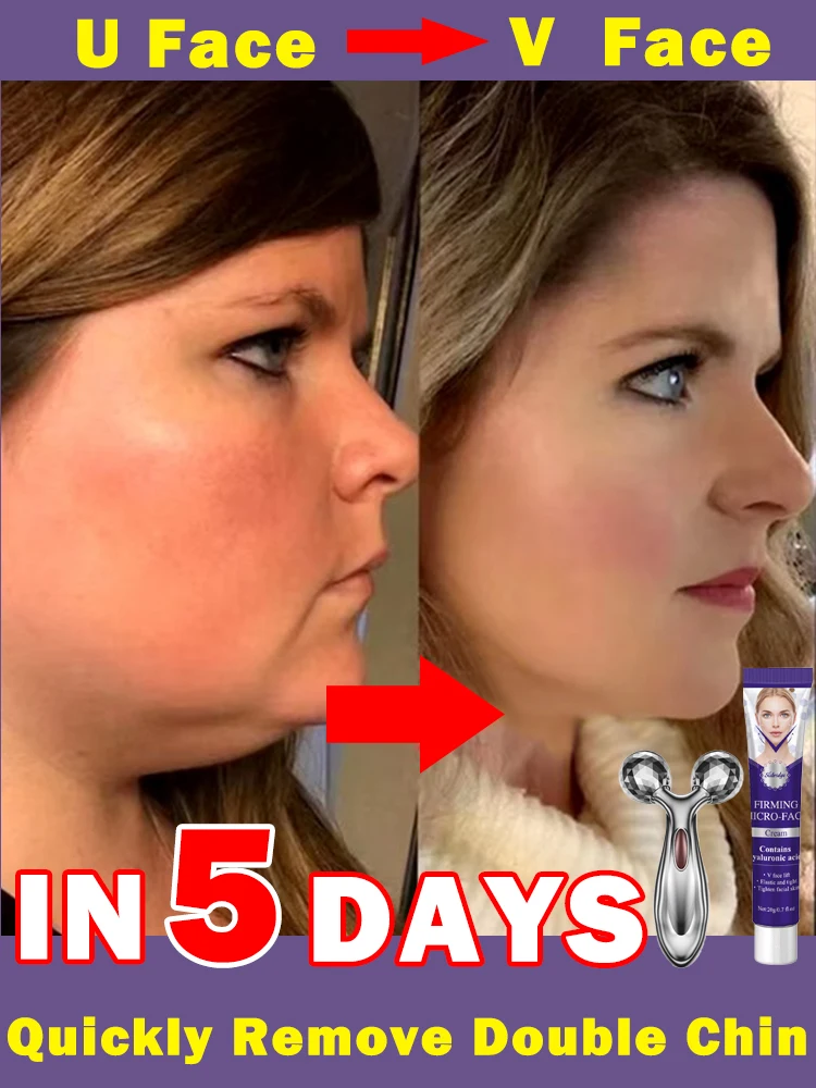 V-shaped firming and lifting creates a more charming facial line