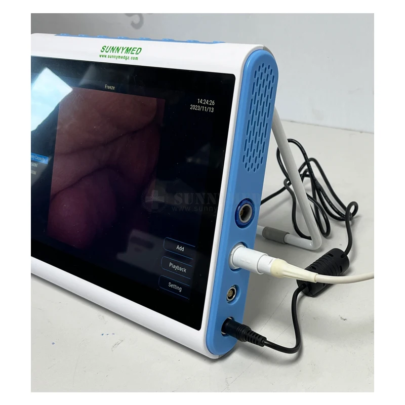 SY-P030_1M Multi Compatible Portable Medical Image Processor With TFT for Clinic ENT Gynecology Urology Endoscopy