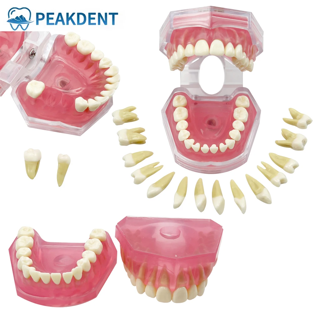 

Dental Typodont Study Teaching Model Soft Gum with Removable Teeth M7008 For Patient Education Demo Extraction Pratice Product