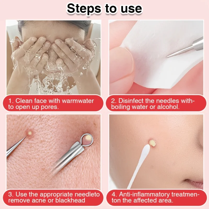 4pcs Set of Premium Stainless Steel Precision Tweezers , Blackhead, And Pimple Remover, Professional Facial Care Tweezers Acne