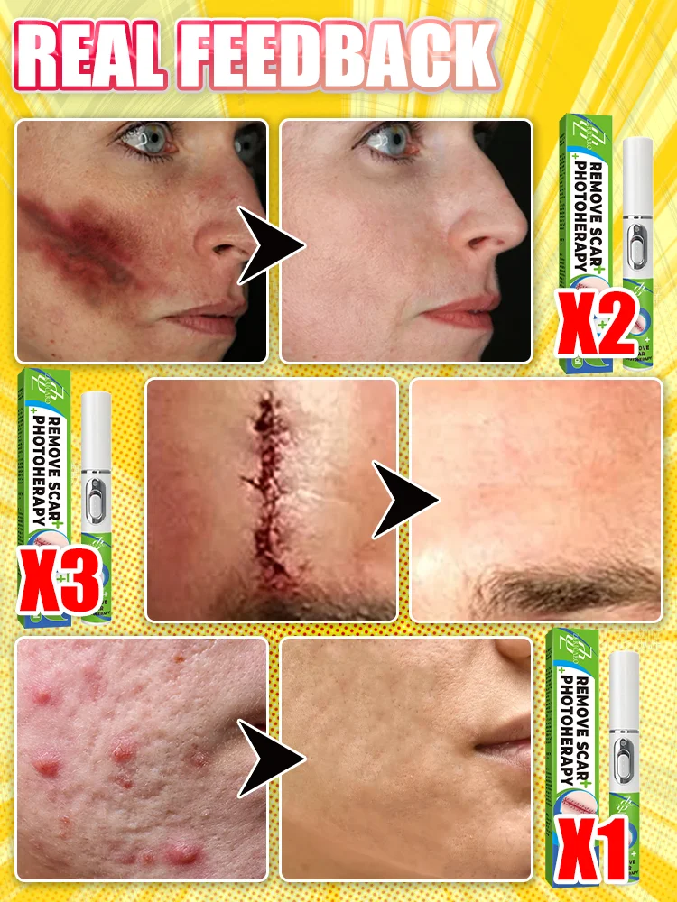 The latest laser equipment in 2025 will restore your skin to health!