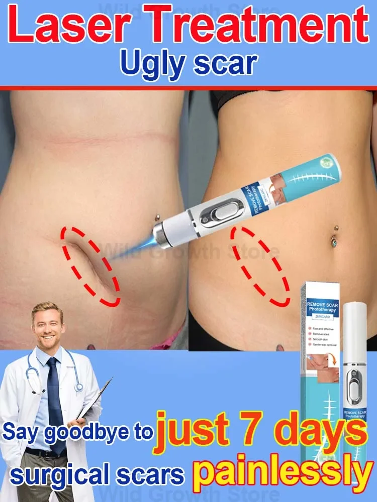 

Laser repair of skin scars