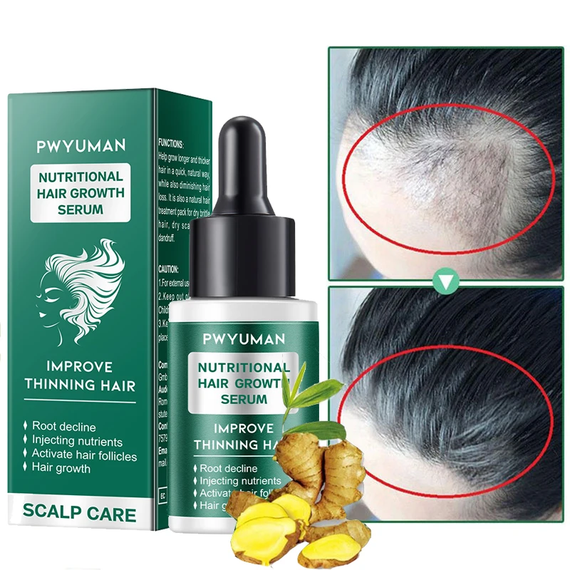 Hair Growth Serum Anti Hair Loss Fast Growing Hair Essential Oil Scalp Treatment Repair Damaged Hair Beauty Health Care Products