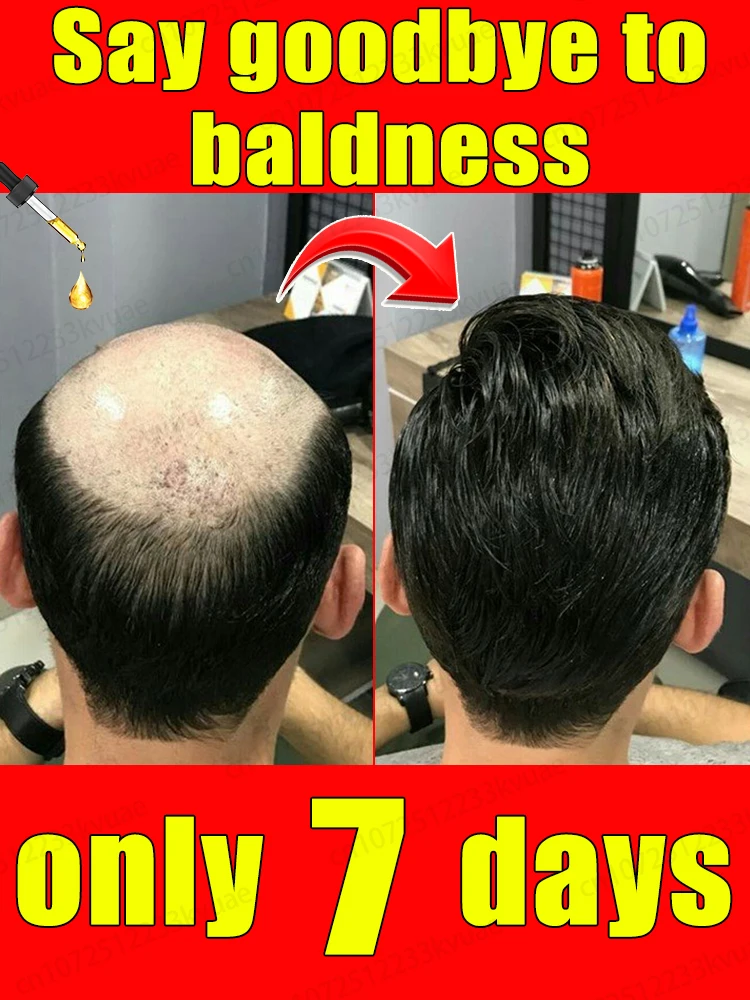 

Say goodbye to baldness, hair growth essential oil will make your hair grow so long that the comb will burst