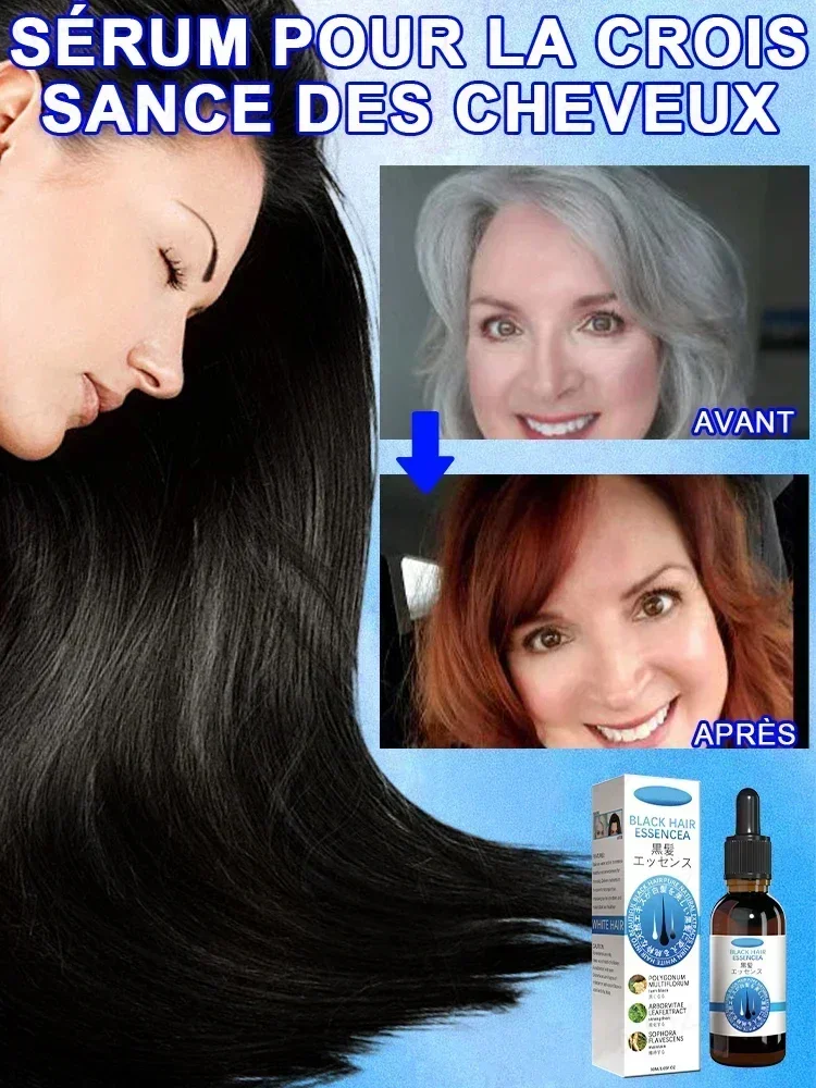 

White hair treatment essence quickly turns white hair into black hair, repairs natural color, and prevents gray hair products