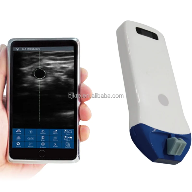 

Wifi 10/14mhz Wireless Ultrasonography Linear Probe for Vascular Cosmetic Doctor+Neurosurgery Department