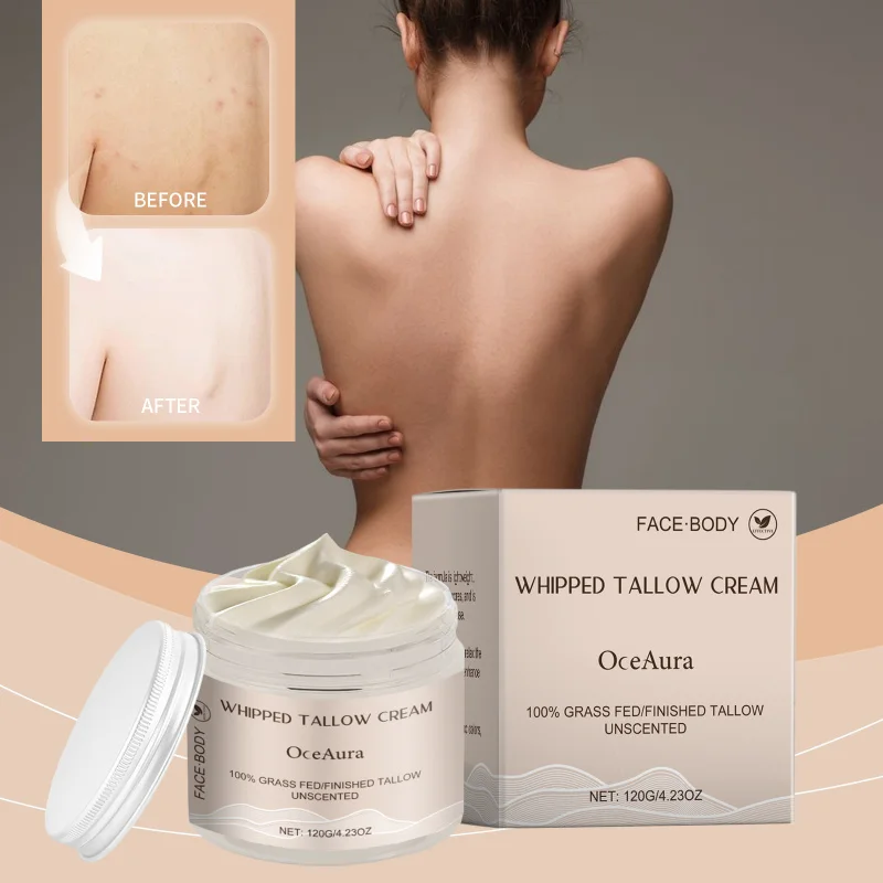 

Grass Fed Tallow Moisturizing Cream - Deep Hydrate, Improve Elasticity, Soothe Dry Skin & Repair Barrier For Face & Body