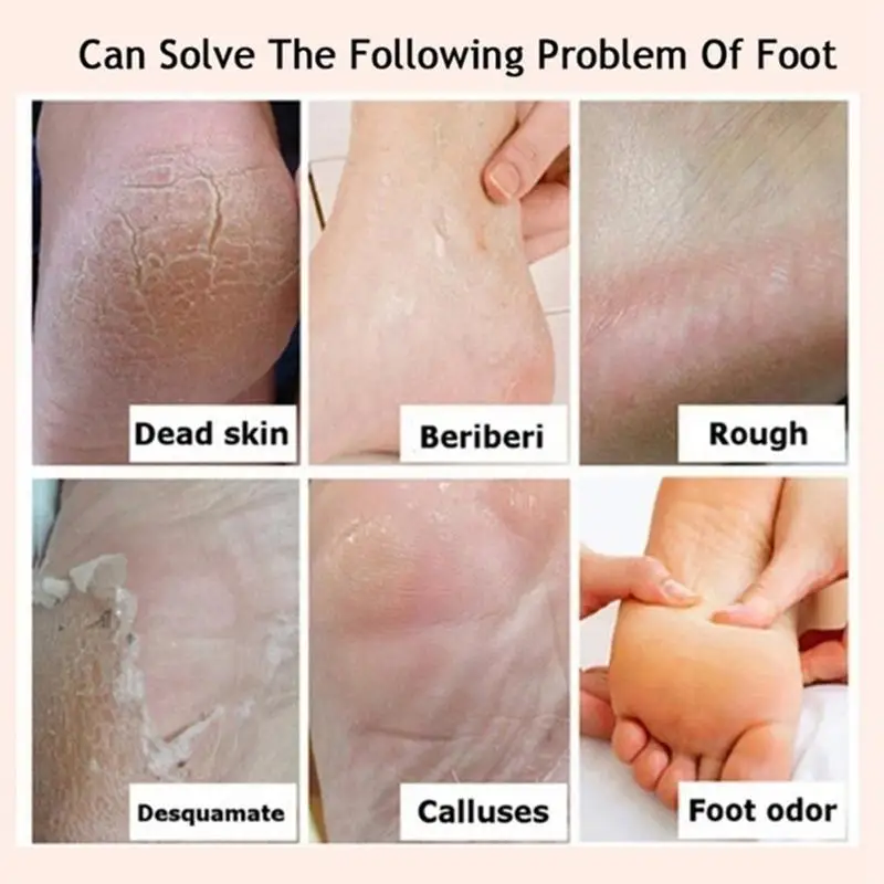 Herbal Anti-Frozen Crack Foot Cream Heel Cream Hand Cream Hydrating Exfoliating Remove Calluses Anti-drying Different Capacity