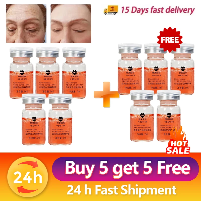 10PCS