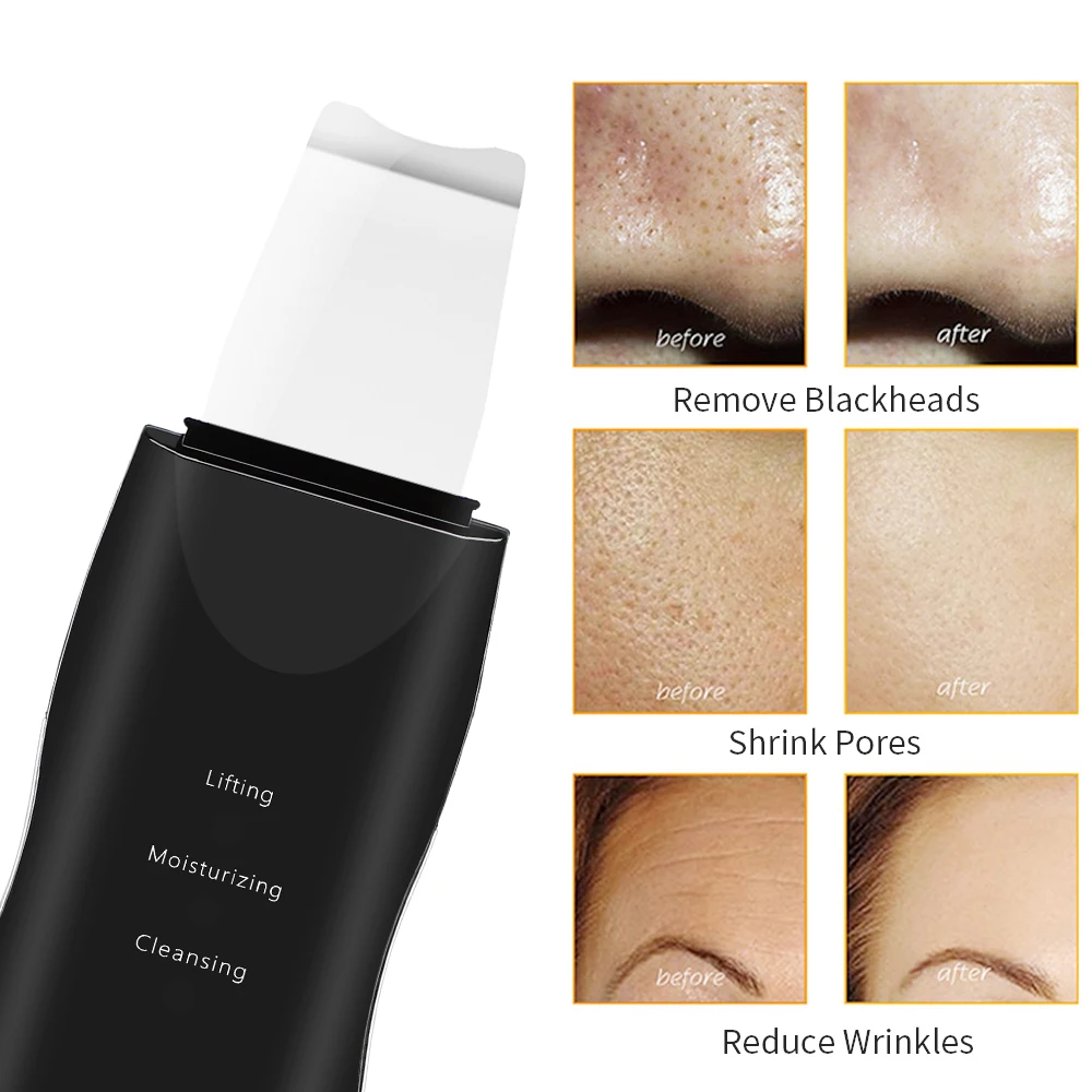 Electric Ultrasonic Facial Cleansing Instrument Blackhead Shovel Skin Care Tool for Deep Cleaning And Introduction Therapy