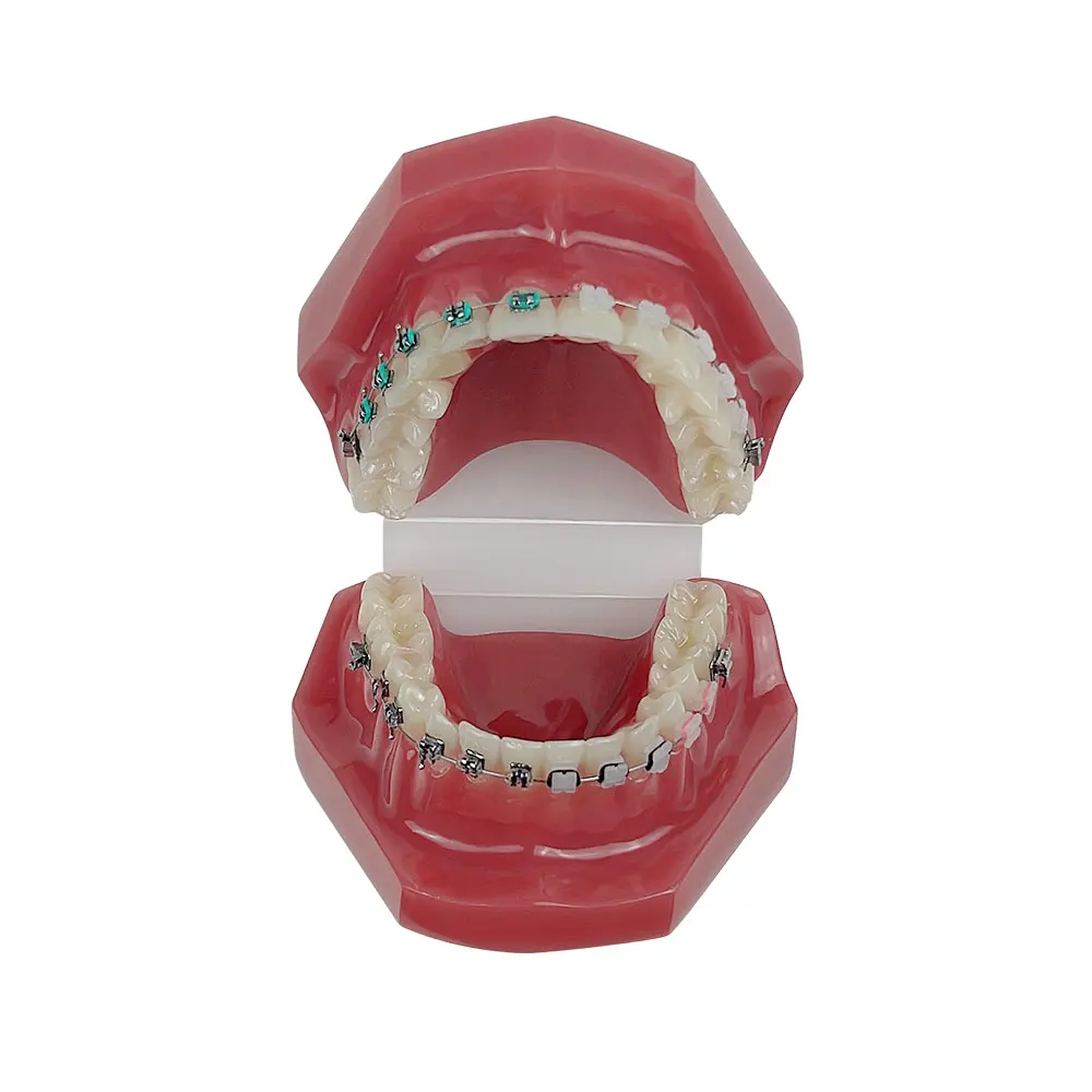 Dental Orthodontic Teeth Study Model With Metal Ceramic Bracket Braces Dentistry Teaching Training Practice Demonstration Tools