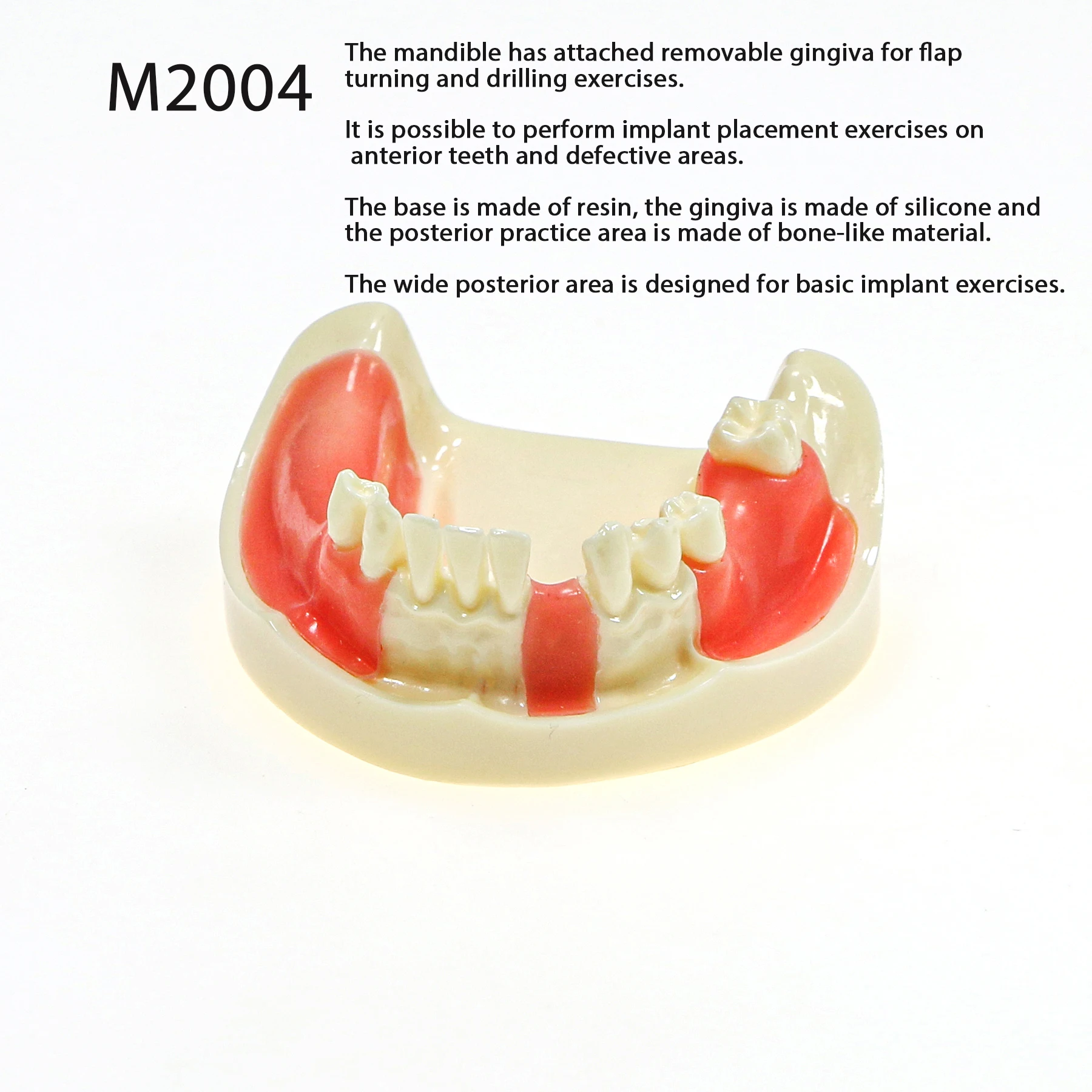 Dental Lower Jaw Implant Practice Model Dentist Educational Student Removable Gingiva Restoration Teaching and Research M2004