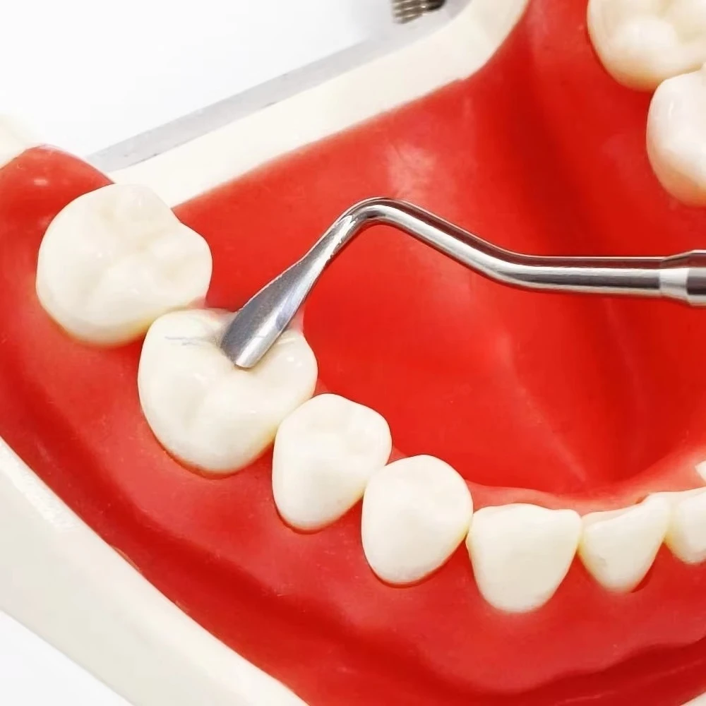 

Filling Tools Posterior for Simplifying Occlusal Modeling of Posterior Teeth Modeling Tools