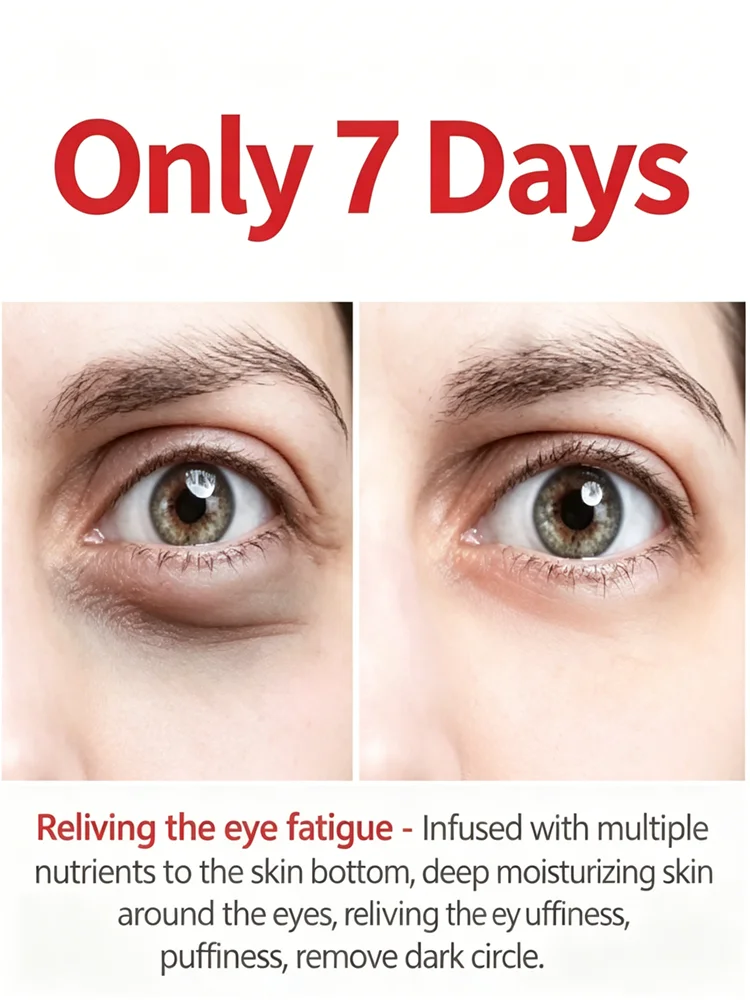 Eye serums for both men and women can improve eye bags and dark circles, and reduce puffiness.
