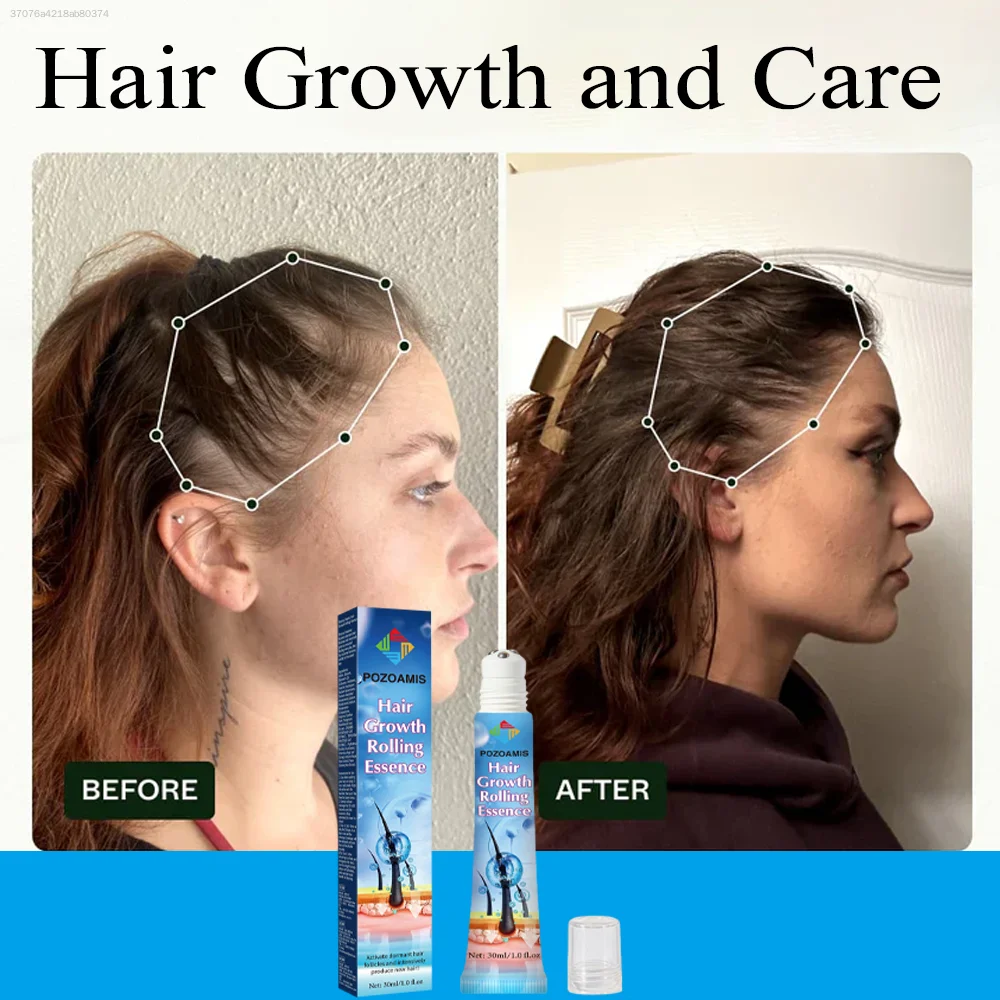 Stop worrying about thinning hairlook handsome and beautiful.