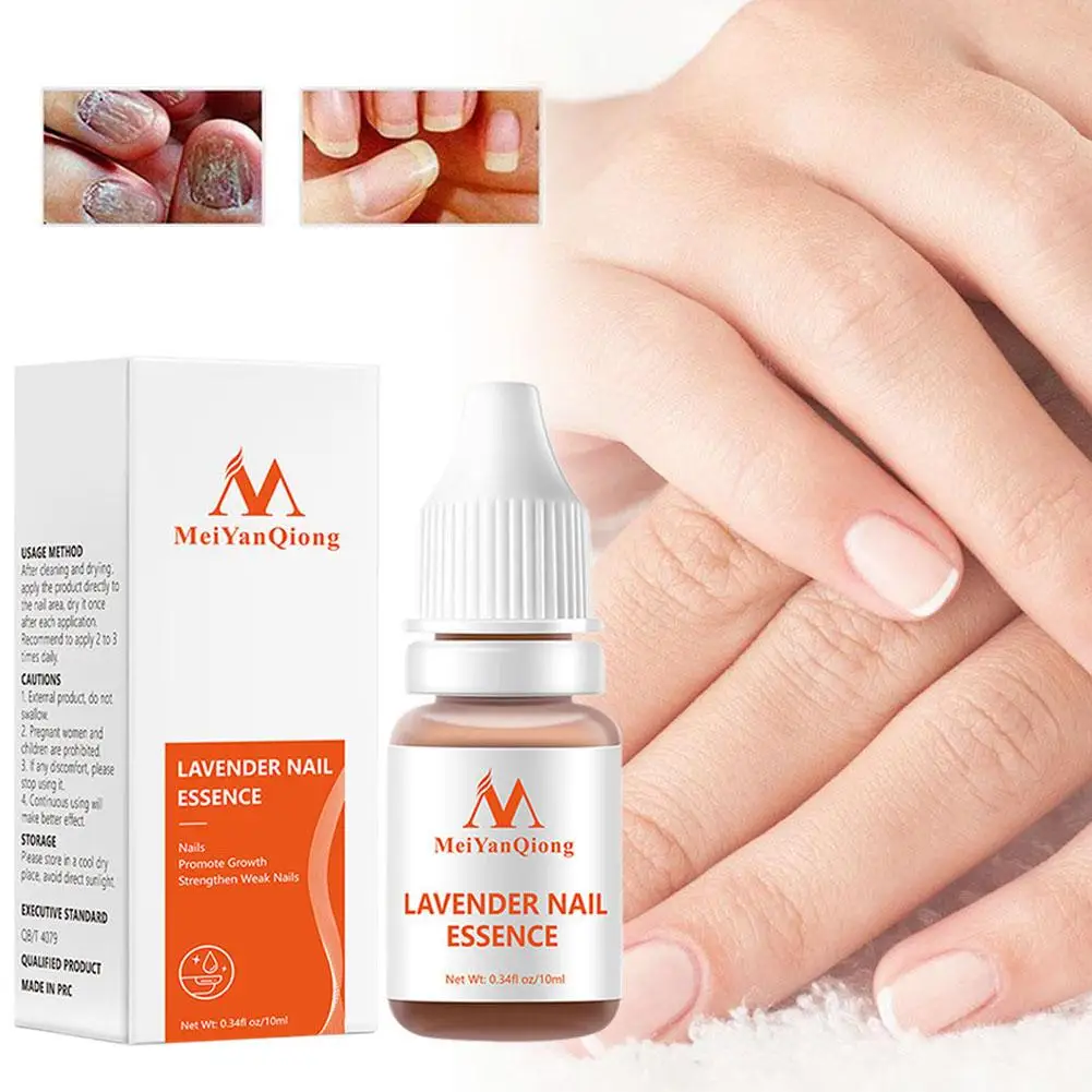 Lavender Fungal Nail TreatmentEssential Oil Nail Art NailsGrow Tools Promote Foot Care Nail Treatment & Healthy O4S8