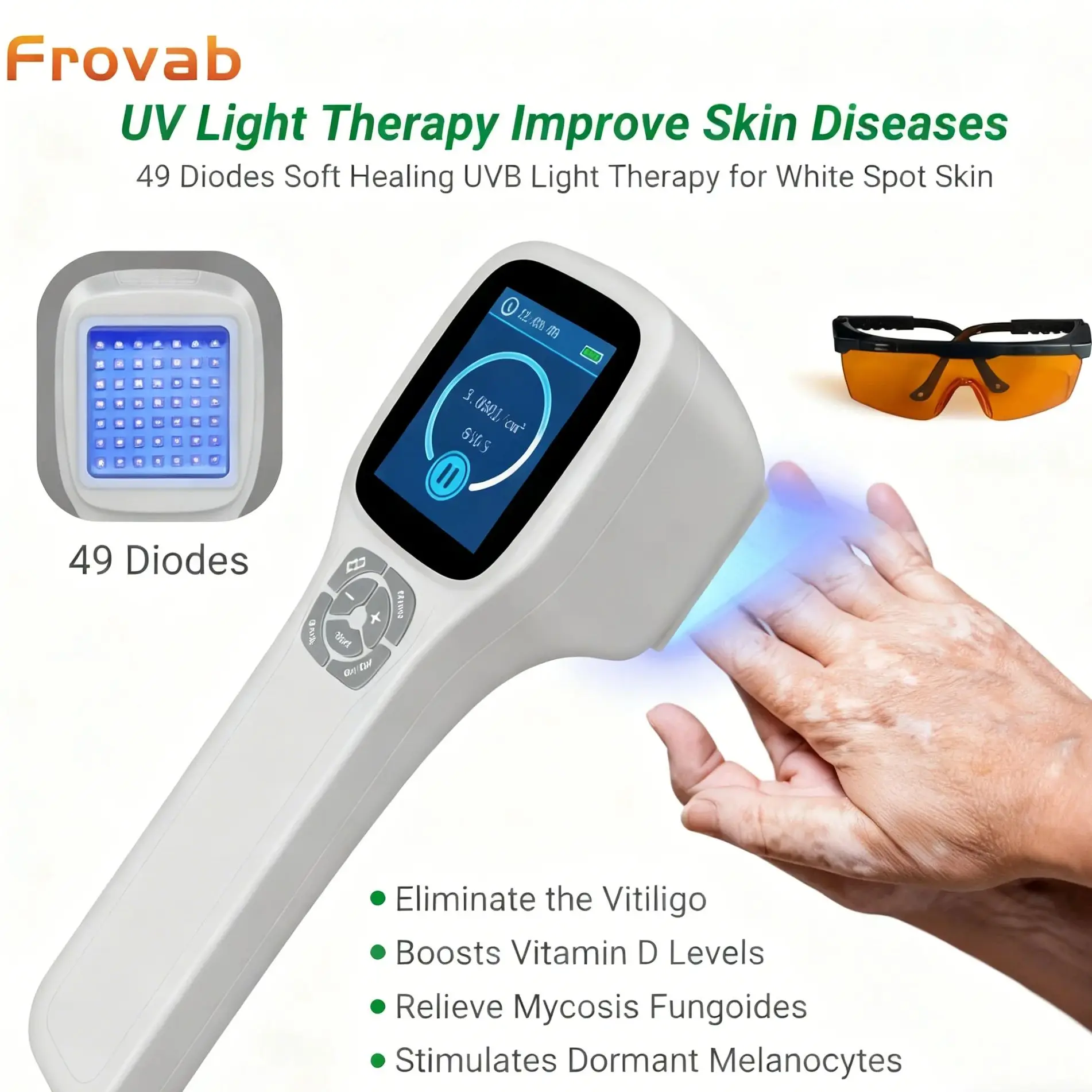 

Аппарат для ультрафиолетовой терапии Frovab, 308 нм, экксимерный свет, UVB-лечение для лечения белых пятен, снятие дерматита кожи, домашнее использование