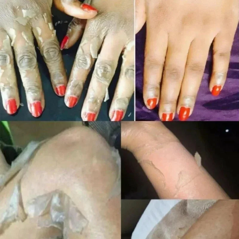 Forte olio peeling giallo Candeggina Pelle scura Lozione sbiancante Schiarire il corpo Gomito Ginocchio Mano Esfolia la pelle morta Nutrire anche il tono della pelle