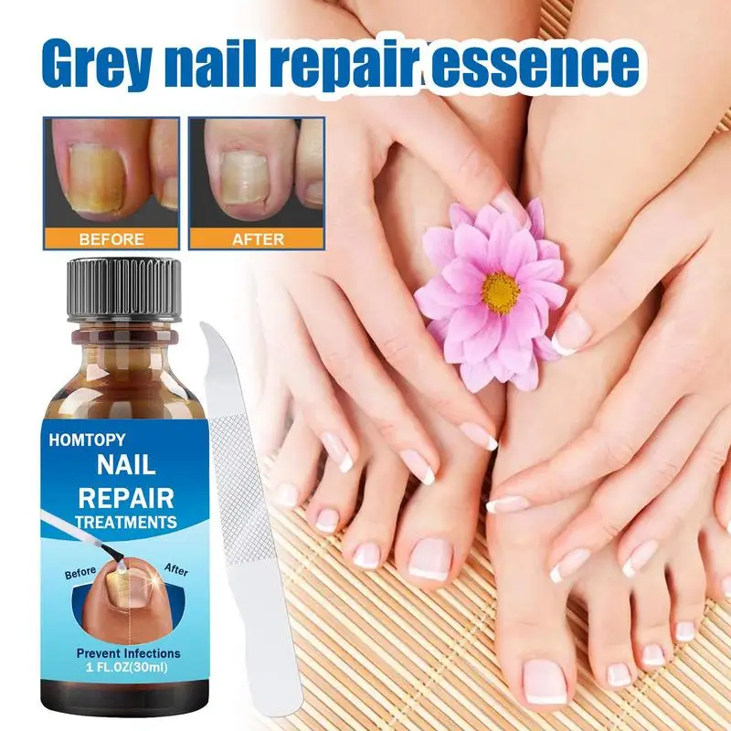 Solution réparatrice pour ongles, renforcement des ongles, soin des mains et des pieds, soucieux pour les doigts et les orteils endommagés, décolorés et fissurés 64.