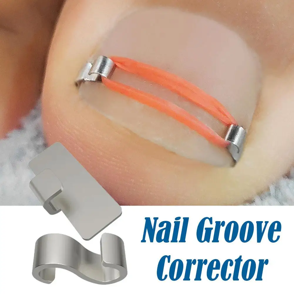 Ingrown Corrector unha para pedicure, Incorporar Toe Nail Treatment, Correção de unha engrown profissional, Pé Care Tool