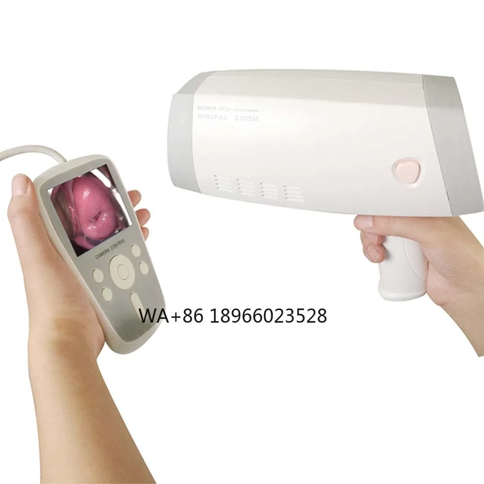 Medical Optics High-resolution video Colposcopy Gynecology Health Colposcopy Digital