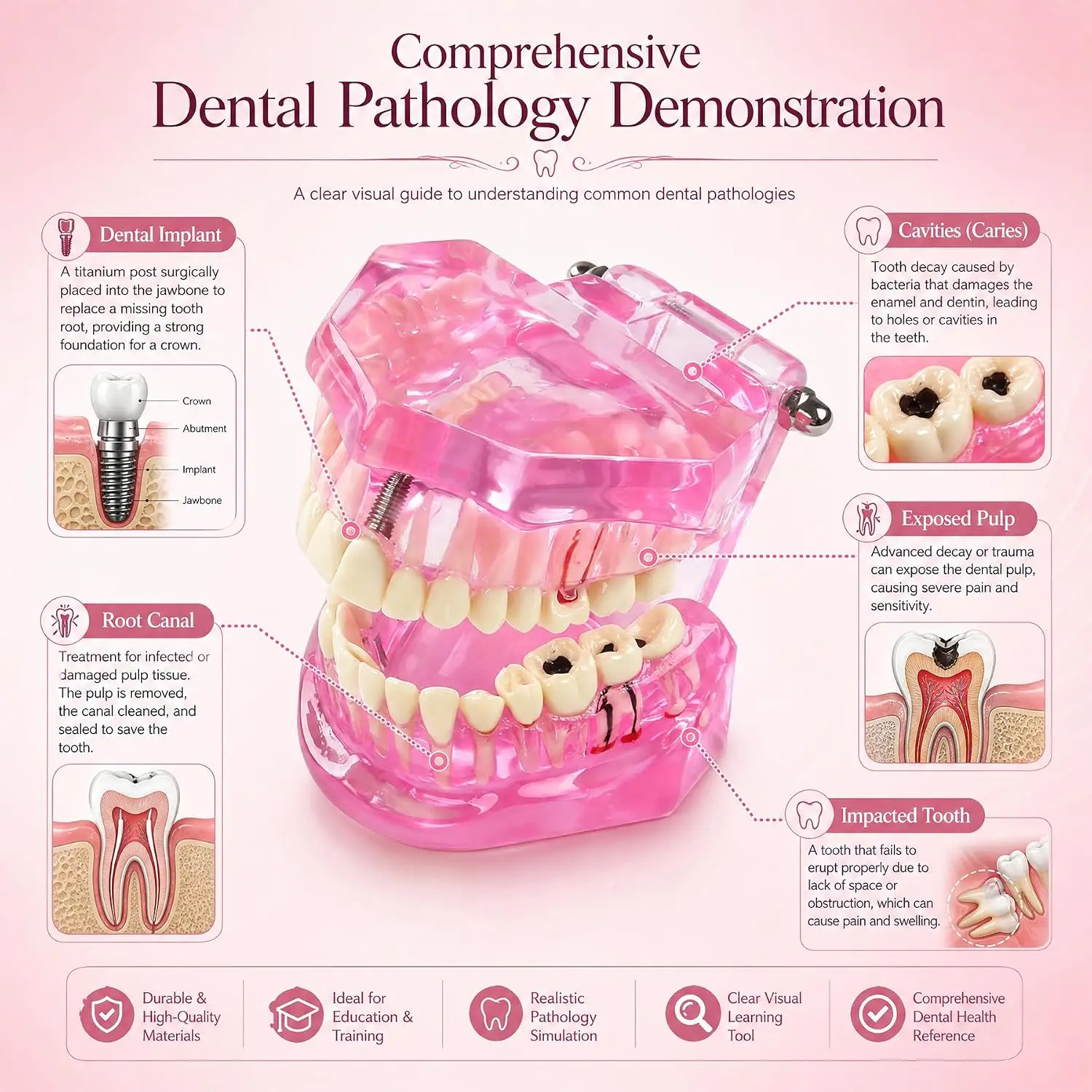 Dental Transparent Disease Teeth Model Implant Teeth Model Removable Crown Bridge Analysis Demonstration Student Education Train