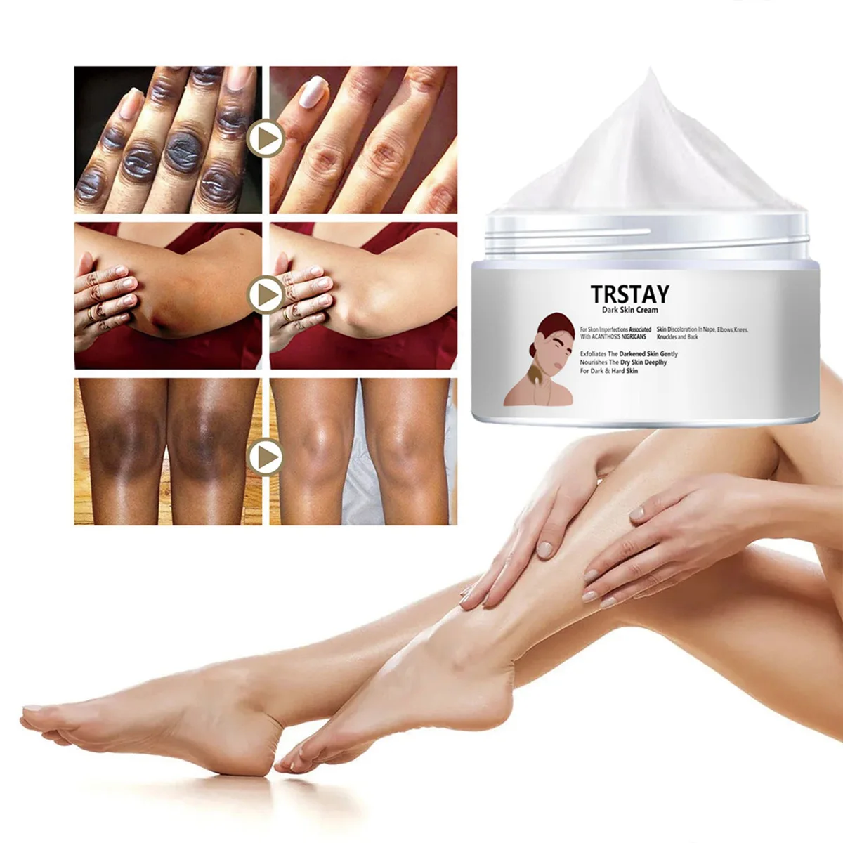 

TRSTAY крем для темной кожи, питательный отбеливающий лосьон для тела для тусклой грубой кожи, глубокое увлажнение суставов, спинки, подходит