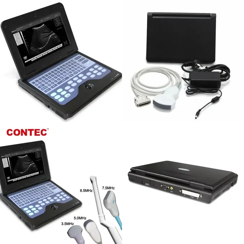 for CONTEC CMS600P2 Portable Ultrasound Machine Real Manufacturer Direct Supply High Quality Medical Imaging Device