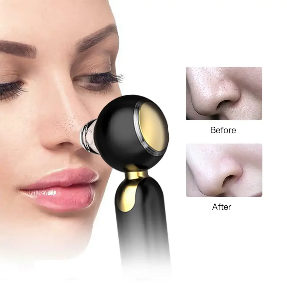 Hot & Cold Electric Vacuum Blackhead Remover Dark Spot Removal Device Beauty Products for Women