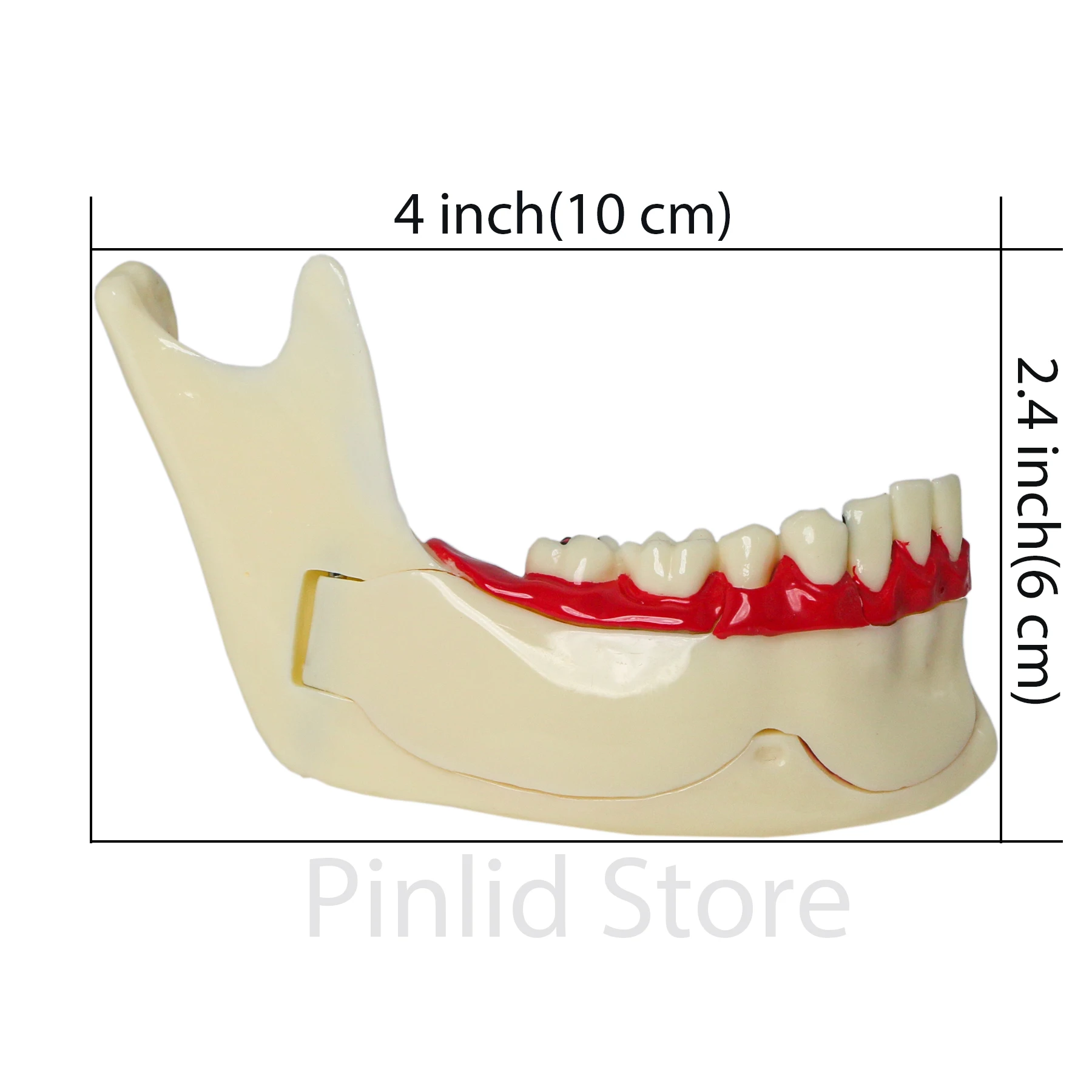 Dental model Endodontic material M4014 Demonstration of adult periodontal disease classification