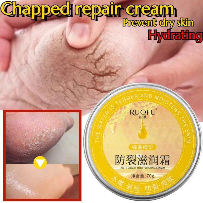 Anti-cracking Cream Heel Fingers Anti-dry Cracking Anti-freeze Crack Repair Chapped Cream Whitening Moisturizing Chapping Cream