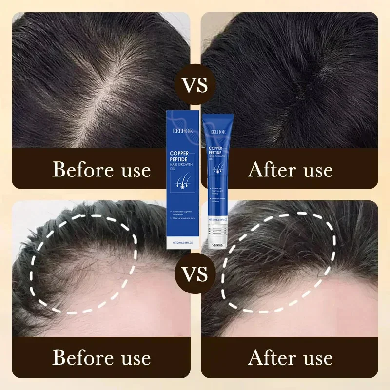 Esencia de cabello rápido eficaz contra la alopecia