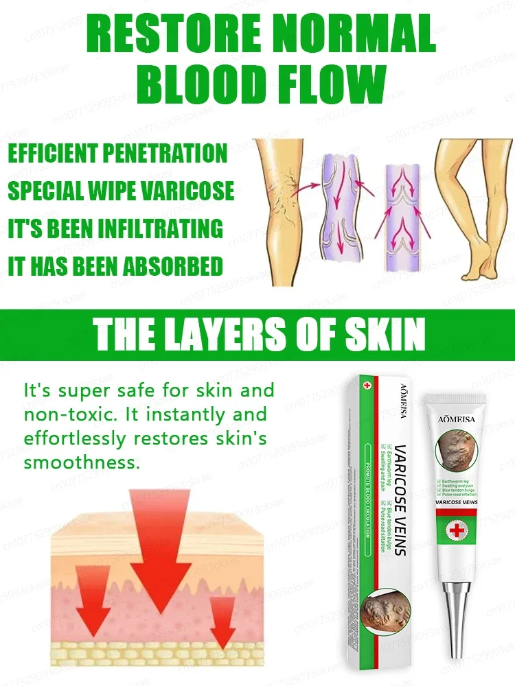 Gel to relieve varicose veins, relieve lumps in legs