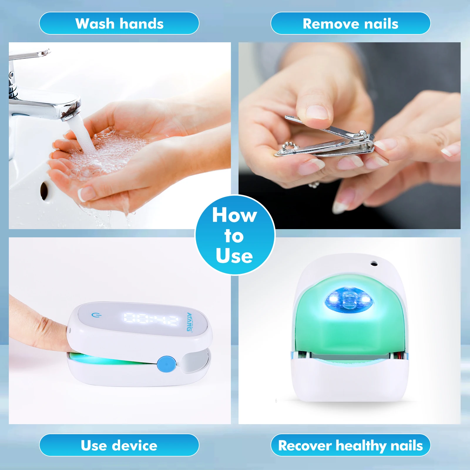 Laser Nail Fungal Treatment Toenail Onychomycosis Nail Fungus Infrared Light Therapy Ingrown Toenail Treatment