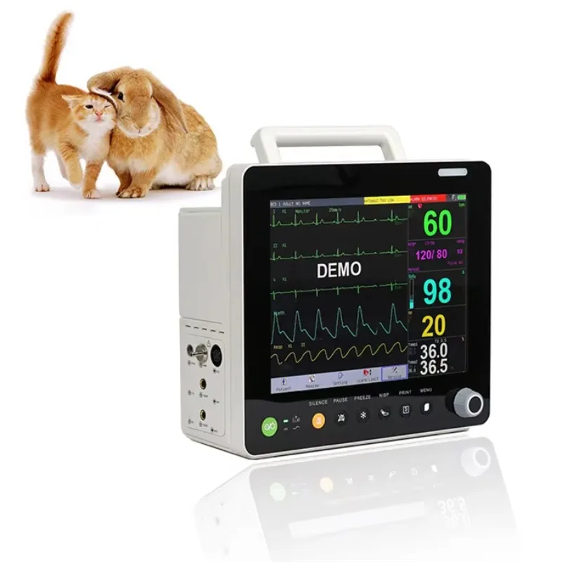 Guangzhou UMY Medical Hospital Portable Multi Parameter 15 Inch ECG Vital Signs Patient Monitor