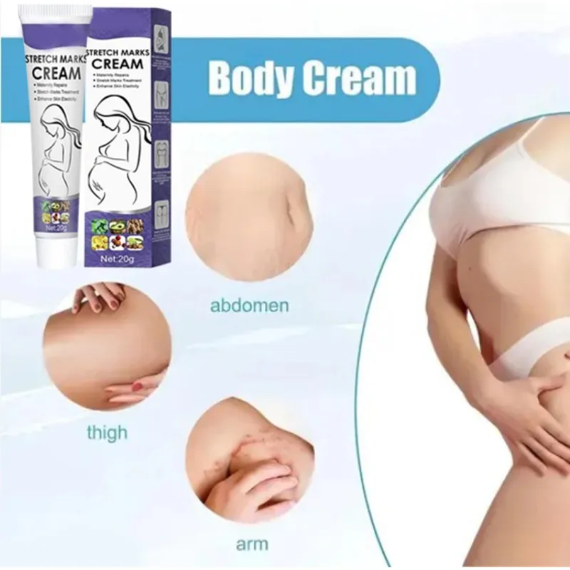 

Skin Care Improves Elasticity Effective After Pregnancy Stretch Marks Removal Powerful Maternity Cream Nourishes Skin