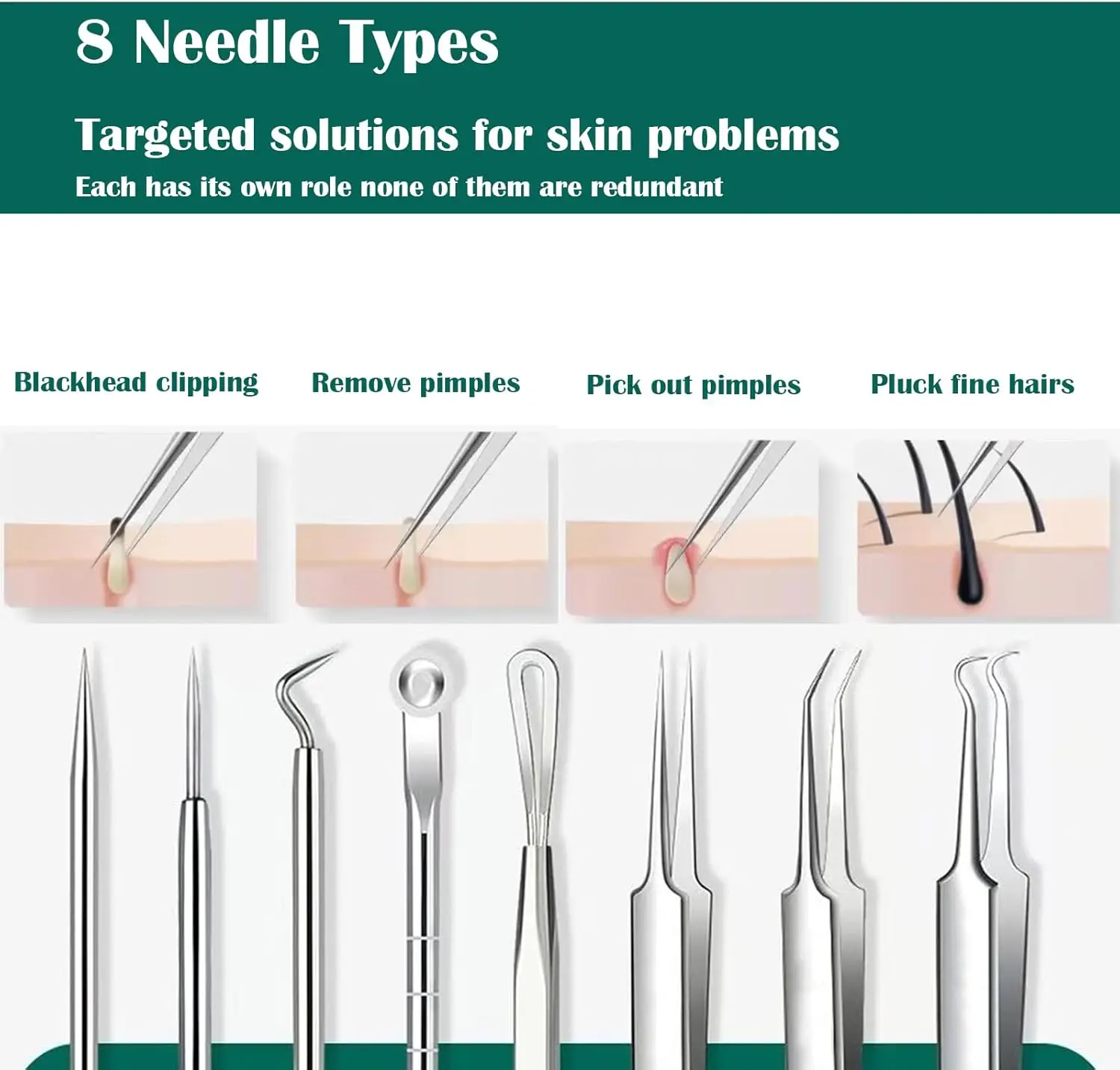プロ仕様の8ピースステンレス製黒ずみ除去キット、精密ピンセット、白ニキビ、ニキビに優しい。