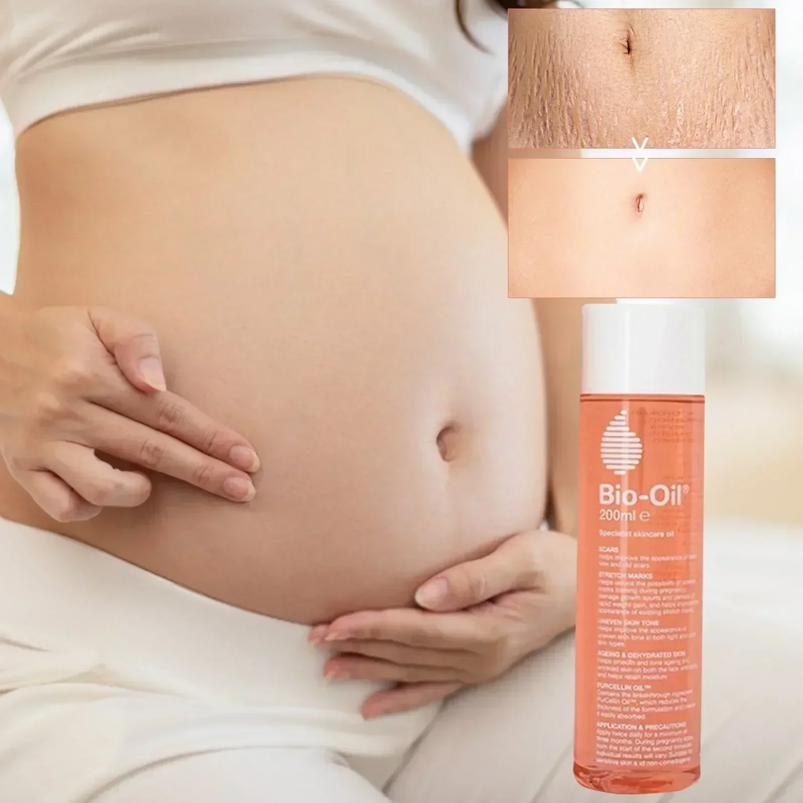 Mild and Non-irritating, Biological Essential Oils Prevent and Fade Pregnancy Obesity Scars