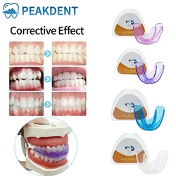 Diş diş telleri diş eğitmeni yetişkinler için diş ortodonti hizalama Brace şeffaf düzeltici diş hekimi diş hizalama aksesuarı