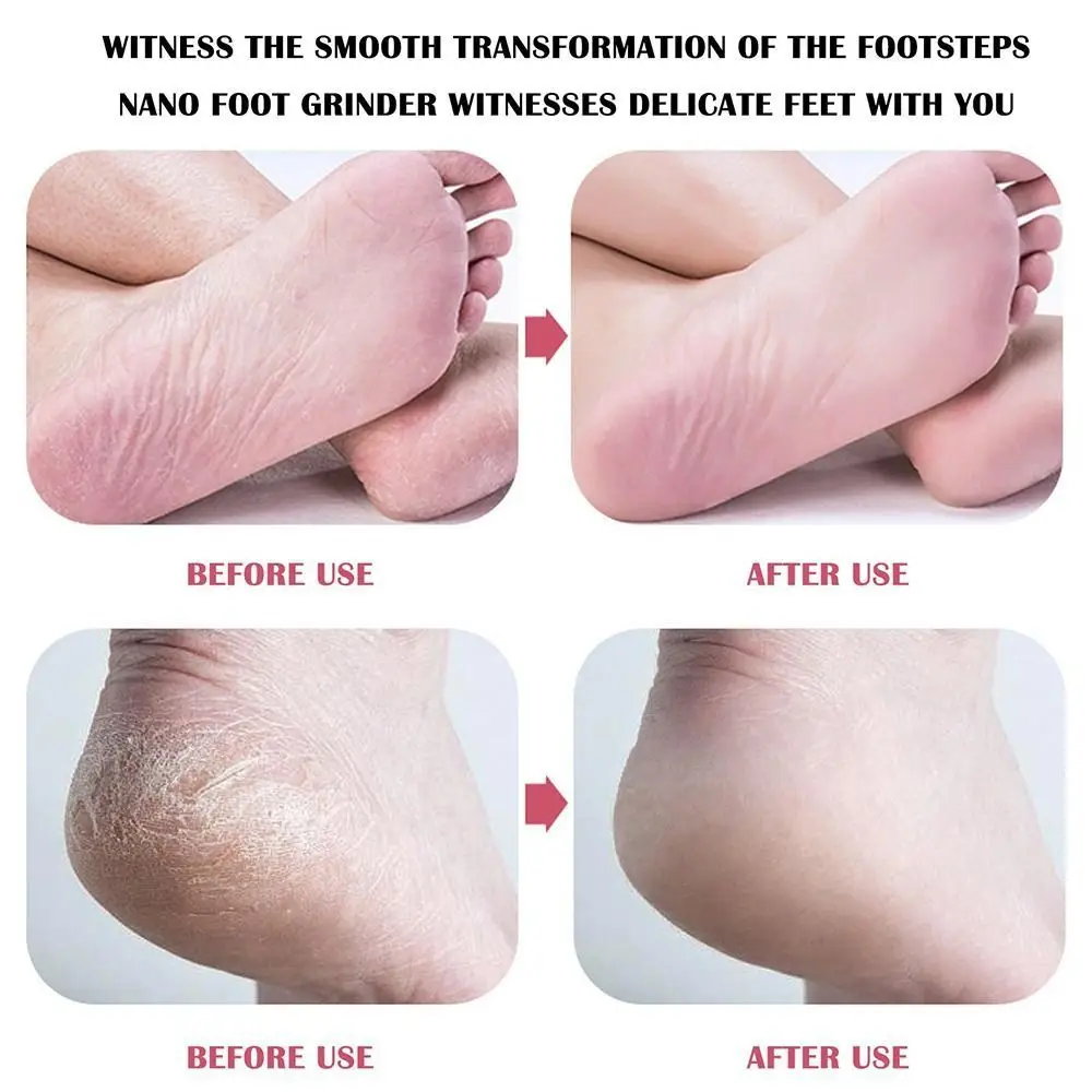 1개 내구성 있는 유리 발 각질 제거기 페디큐어 죽은 피부 제거 플라스틱 힐 스크레이퍼 플레이트 발 파일 보드