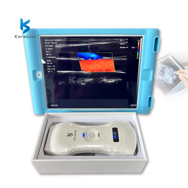 pocket ultrasound device wifi medical portable USB Linear ultrasound probe price 3 in 1 wireless USG