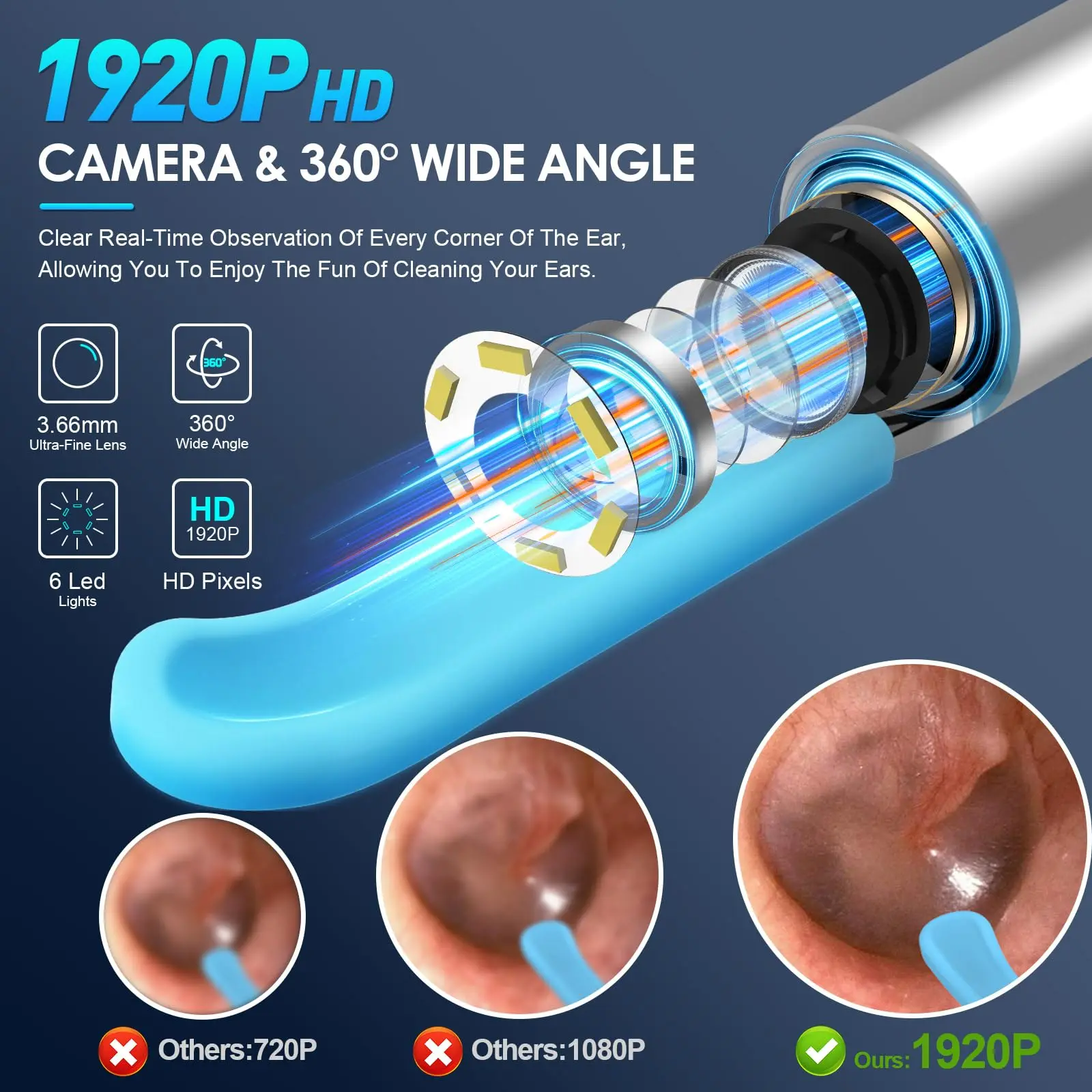 Ear Wax Removal, Upgraded Ear Cleaner with 1920P Camera, Ear Wax Removal Tool Camera with 8 Pcs Ear Set, with 7 Ear Spoon