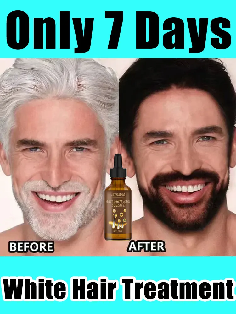 

Improve Various Gray Hairs Problems And Restores Natural Hair Color