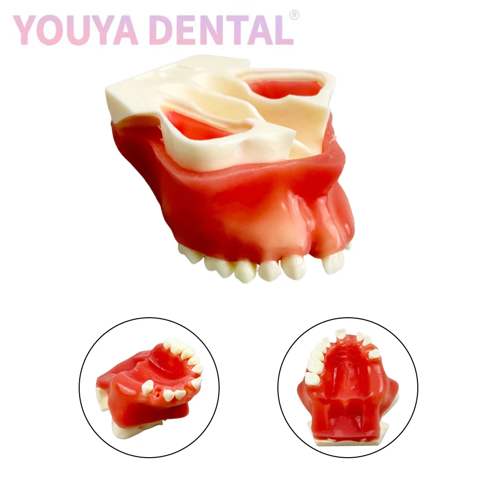 

New Dental Implant Practice Model Missing Tooth Soft Gum Maxillary Sinus Typodont Tooth Model For Dental Students' Oral Training