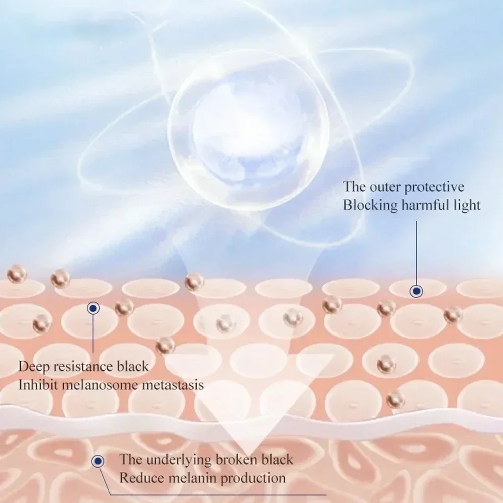 Crema blanqueadora antipecas, ilumina el tono de la piel, elimina las pecas, aclara las manchas, ilumina el Chloasma, hidrata el cuidado de la piel facial