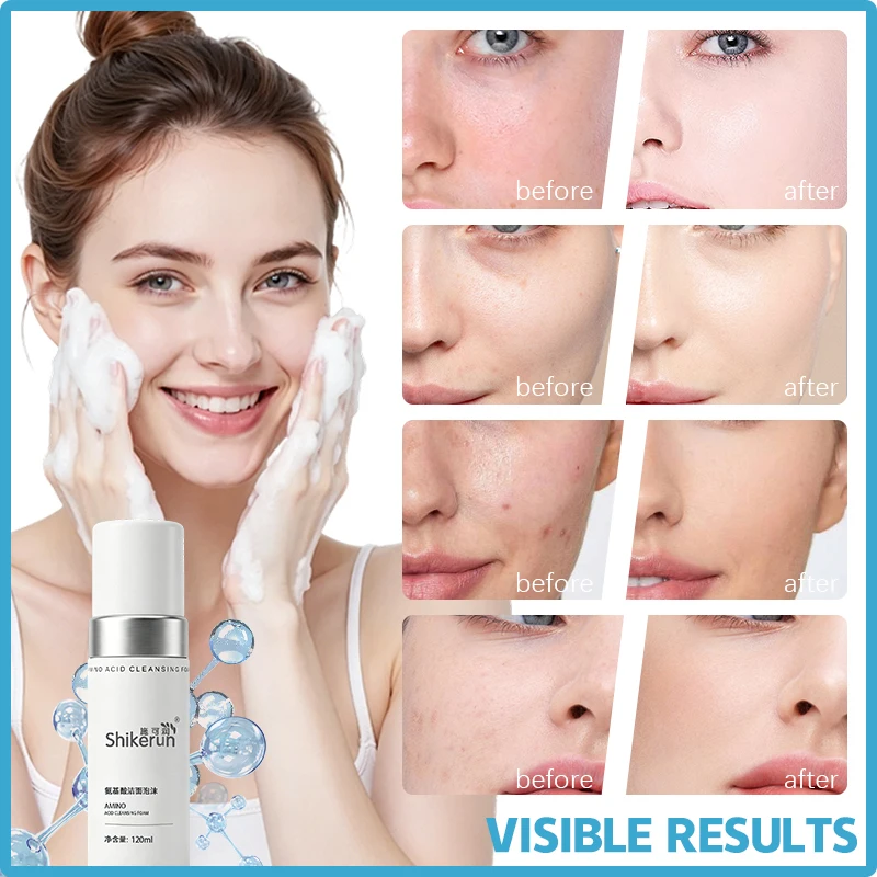 Mousse Deep cleanser Daily Face Massasge Facial Hydra Moisturizing Skin For Sensitive Skin Refreshingly Soft Lightweight Foam