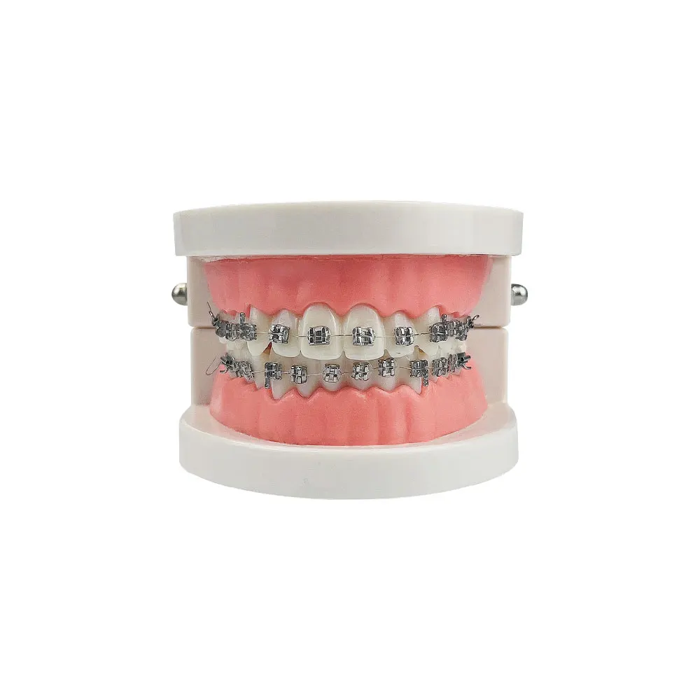 Typodont ortodôntico dental com suporte do metal, Arch Wire, Demonstração do estudo do dentista, modelo dos dentes